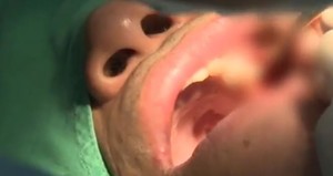 thumbimg